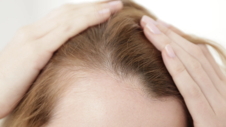 Top-Rated Hair Loss Treatment Doctor in Gaithersburg, Maryland